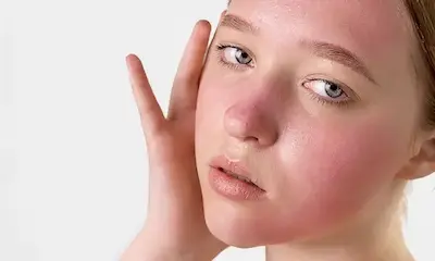 Arsuri solare