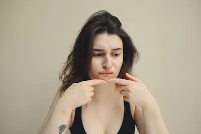 Probleme ale pielii