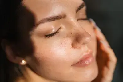 Exces de sebum